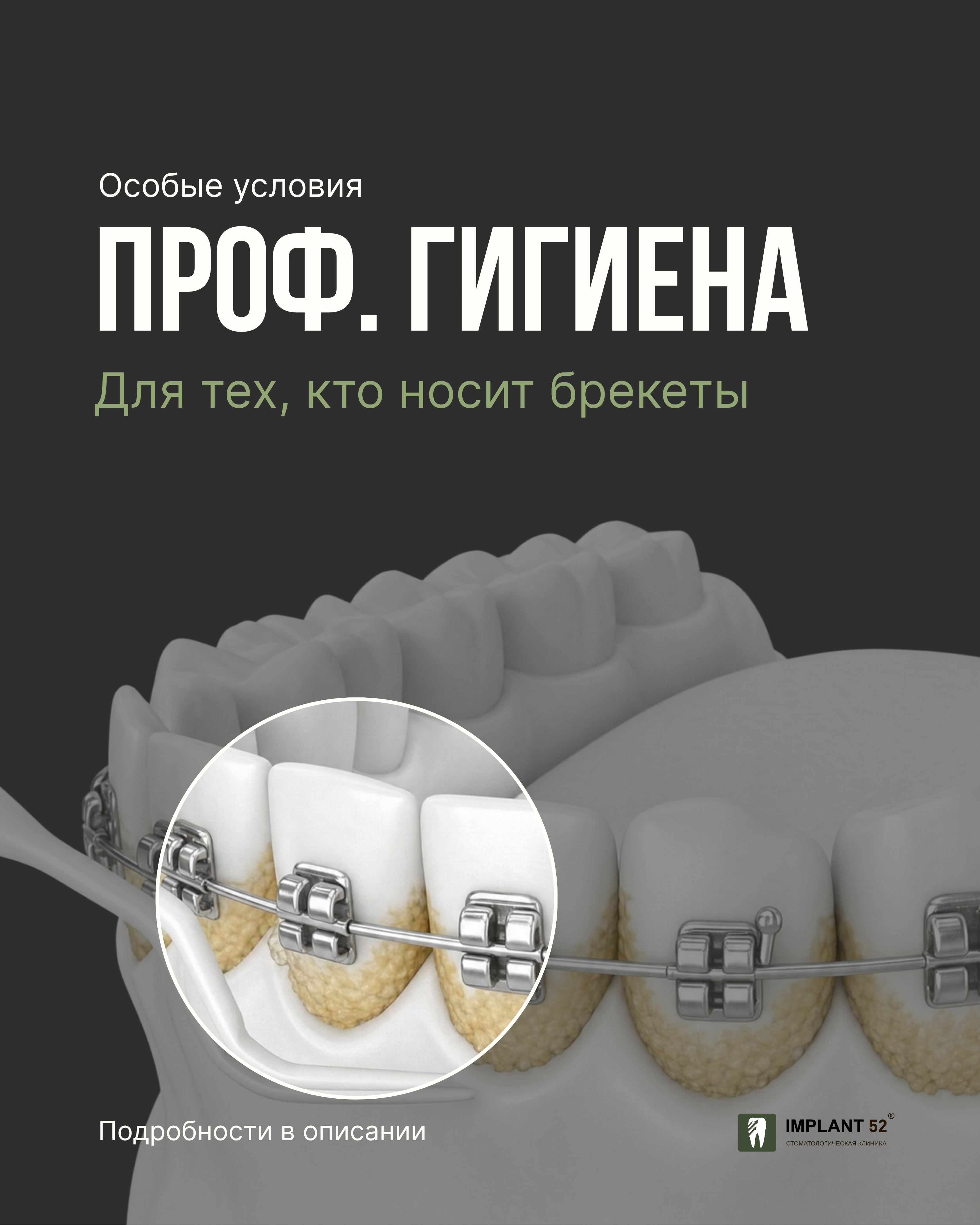 Ortho гигиена доступна всем
