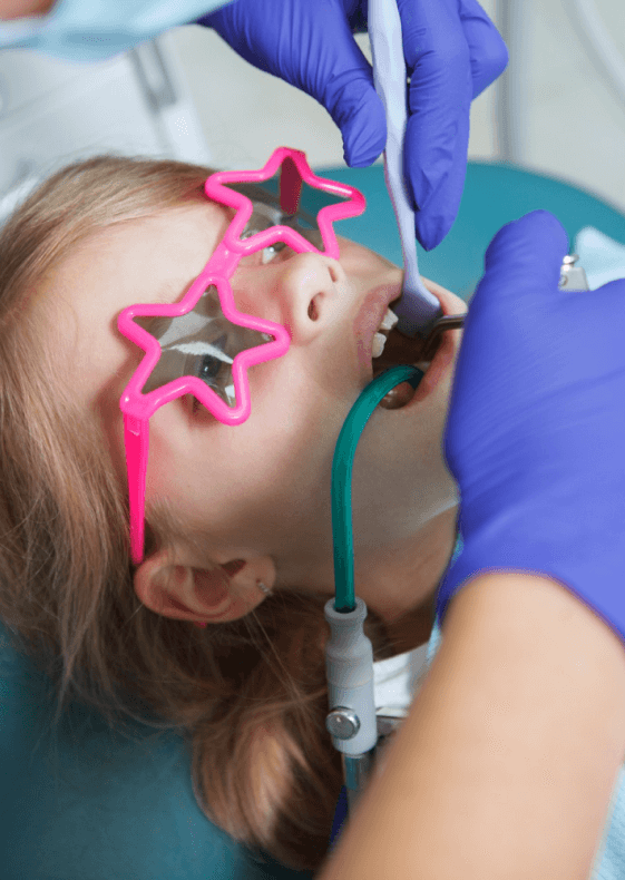 Лечение кариеса у детей