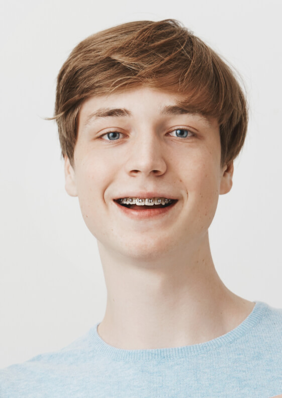 Исправление прикуса