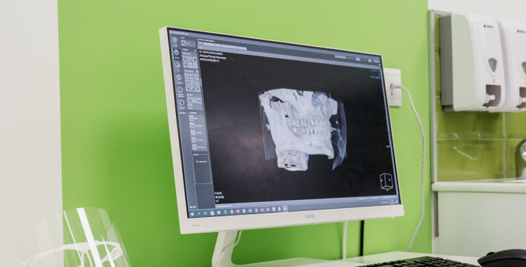 3D-томография зубов