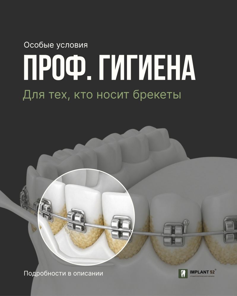 Ortho гигиена доступна всем